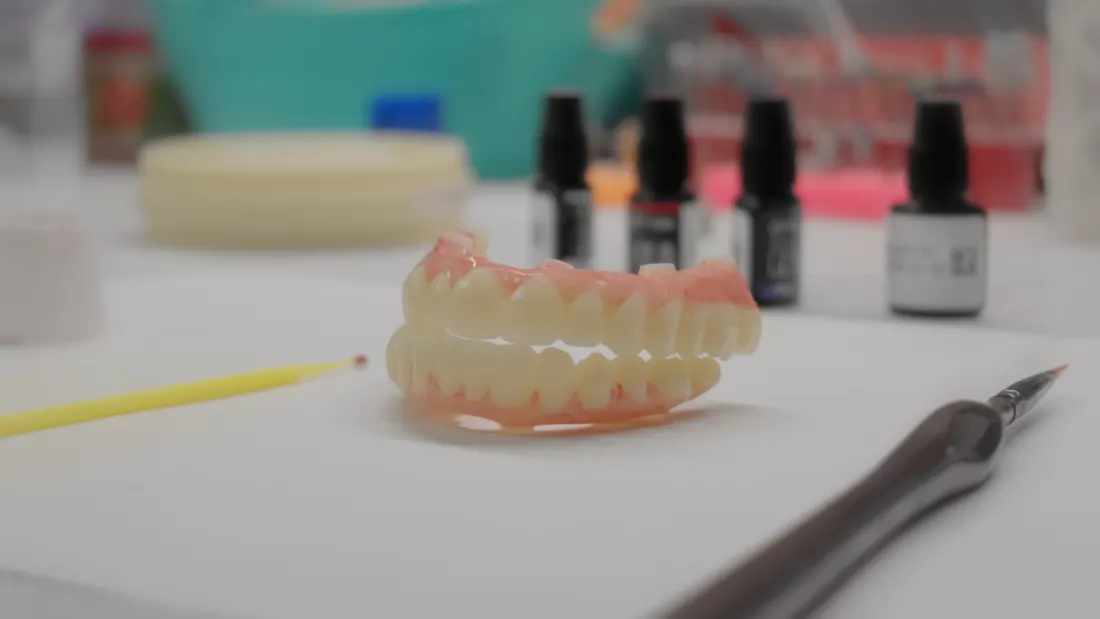 Full-arch restoration on the laboratory workbench