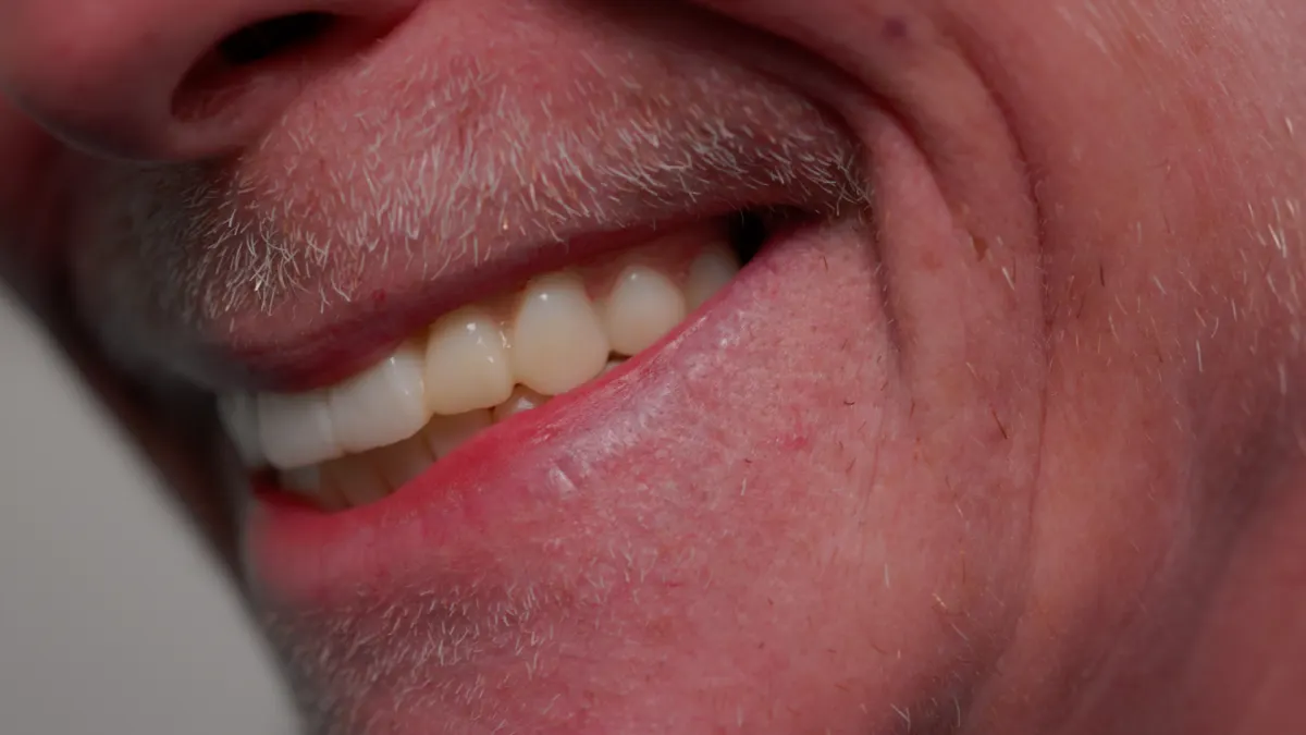 Close-up of a natural-looking smile